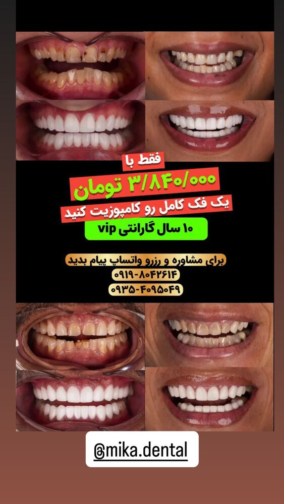  جدید ترین استوری اینستاگرام الناز مهدیان
