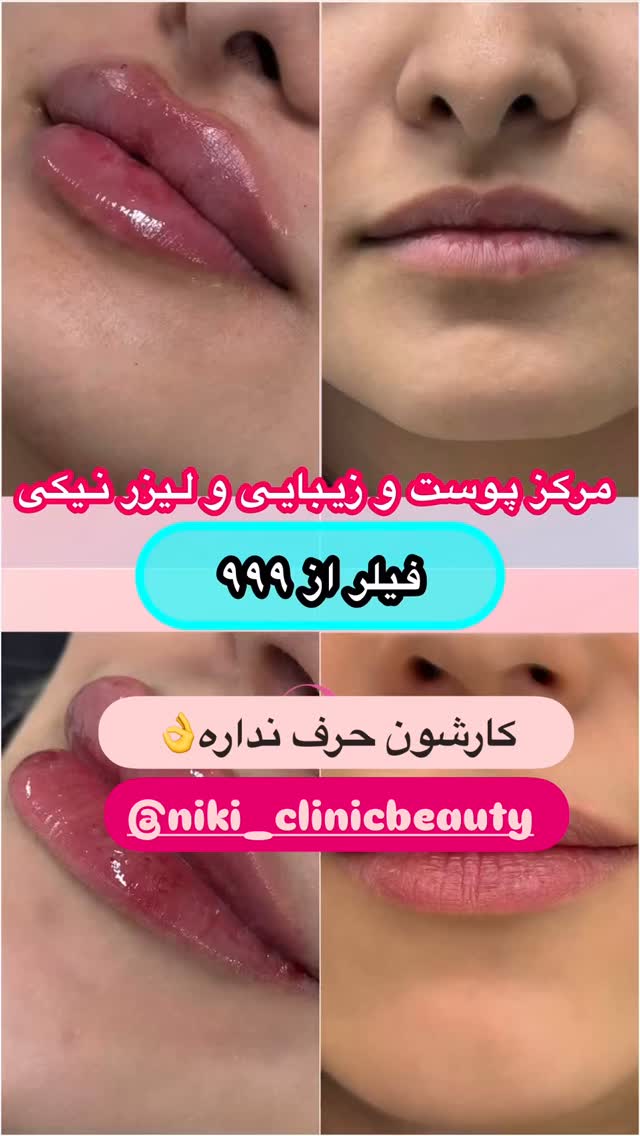  جدید ترین استوری اینستاگرام الهه صاحبقران