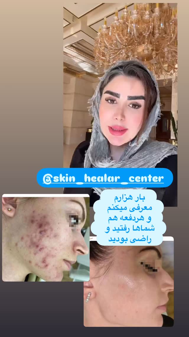 جدید ترین استوری اینستاگرام الهه صاحبقران