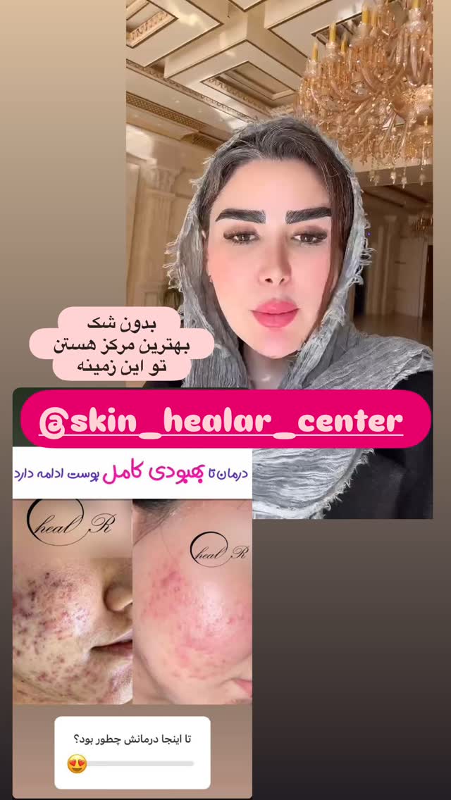  جدید ترین استوری اینستاگرام الهه صاحبقران