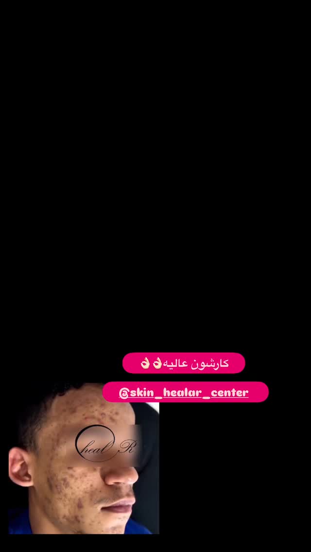  جدید ترین استوری اینستاگرام الهه صاحبقران