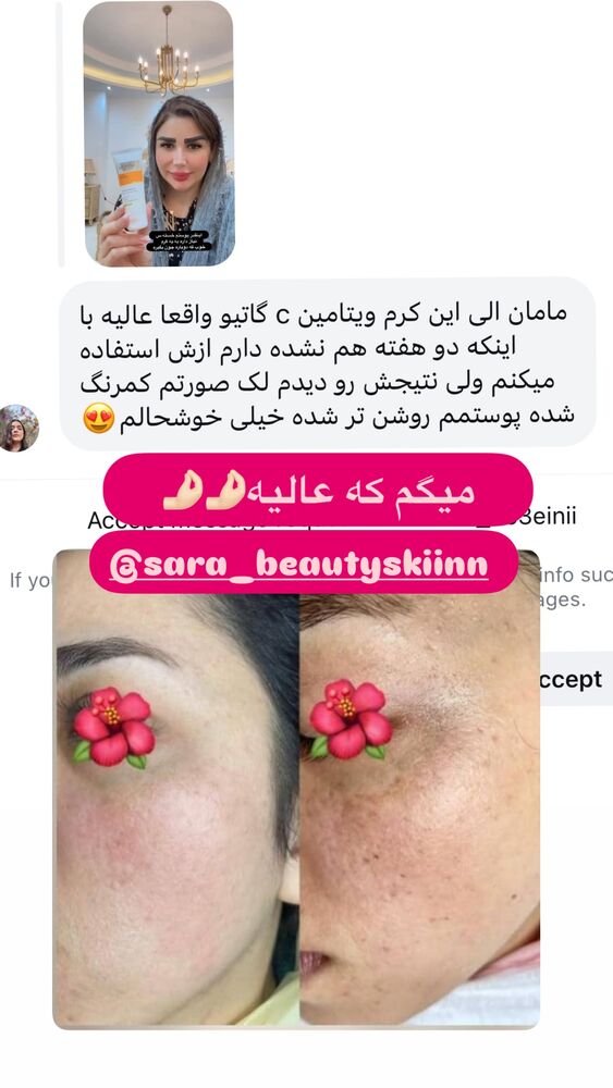  جدید ترین استوری اینستاگرام الهه صاحبقران