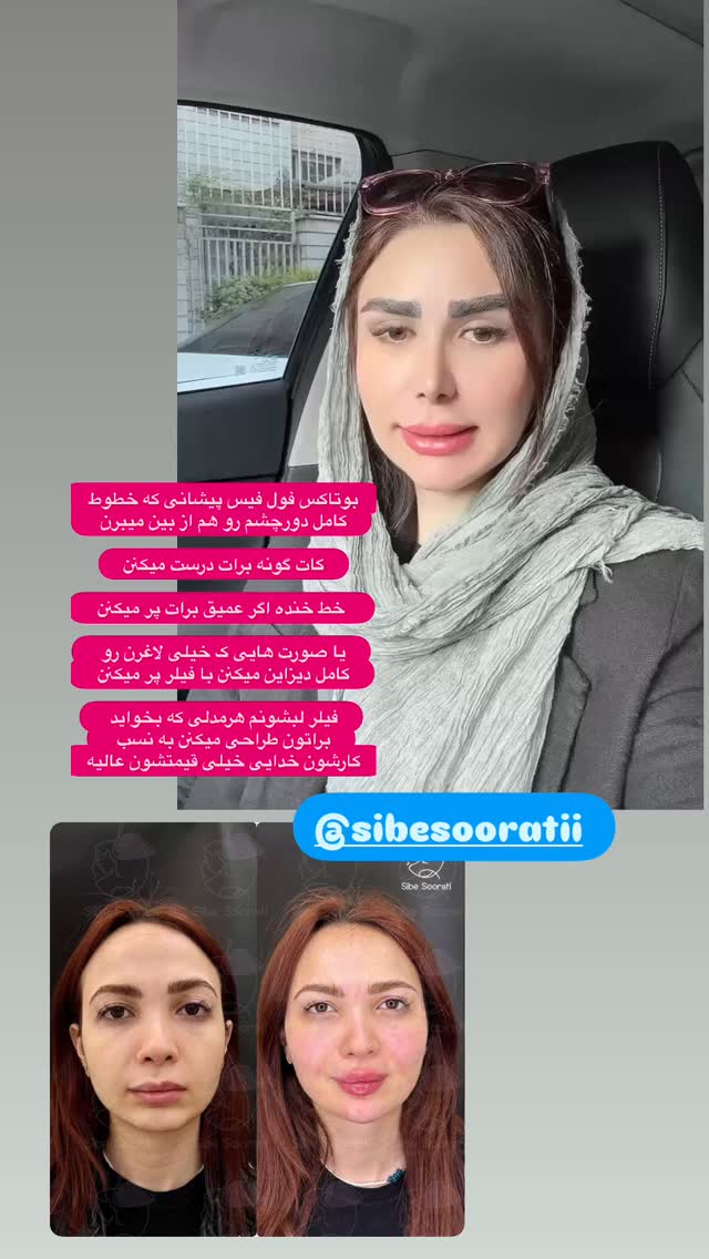  جدید ترین استوری اینستاگرام الهه صاحبقران