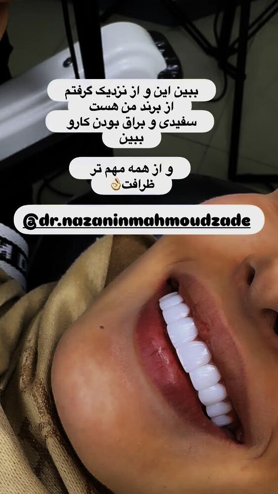  جدید ترین استوری اینستاگرام الهه صاحبقران