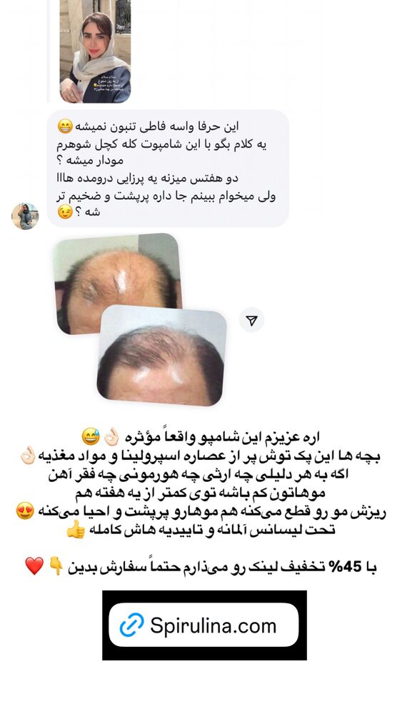  جدید ترین استوری اینستاگرام الهه صاحبقران