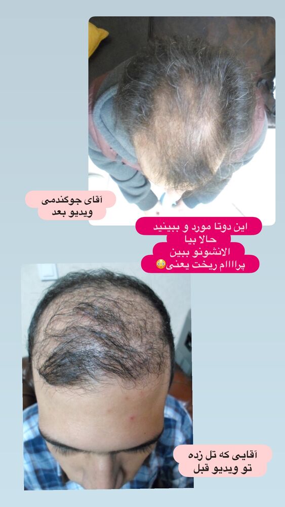  جدید ترین استوری اینستاگرام الهه صاحبقران
