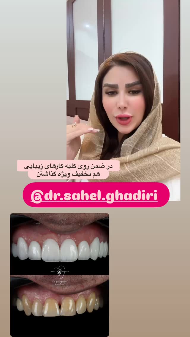  جدید ترین استوری اینستاگرام الهه صاحبقران
