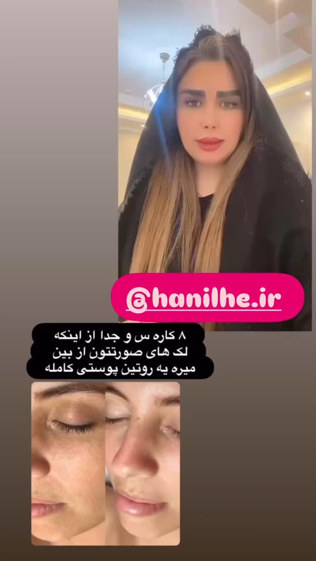  جدید ترین استوری اینستاگرام الهه صاحبقران