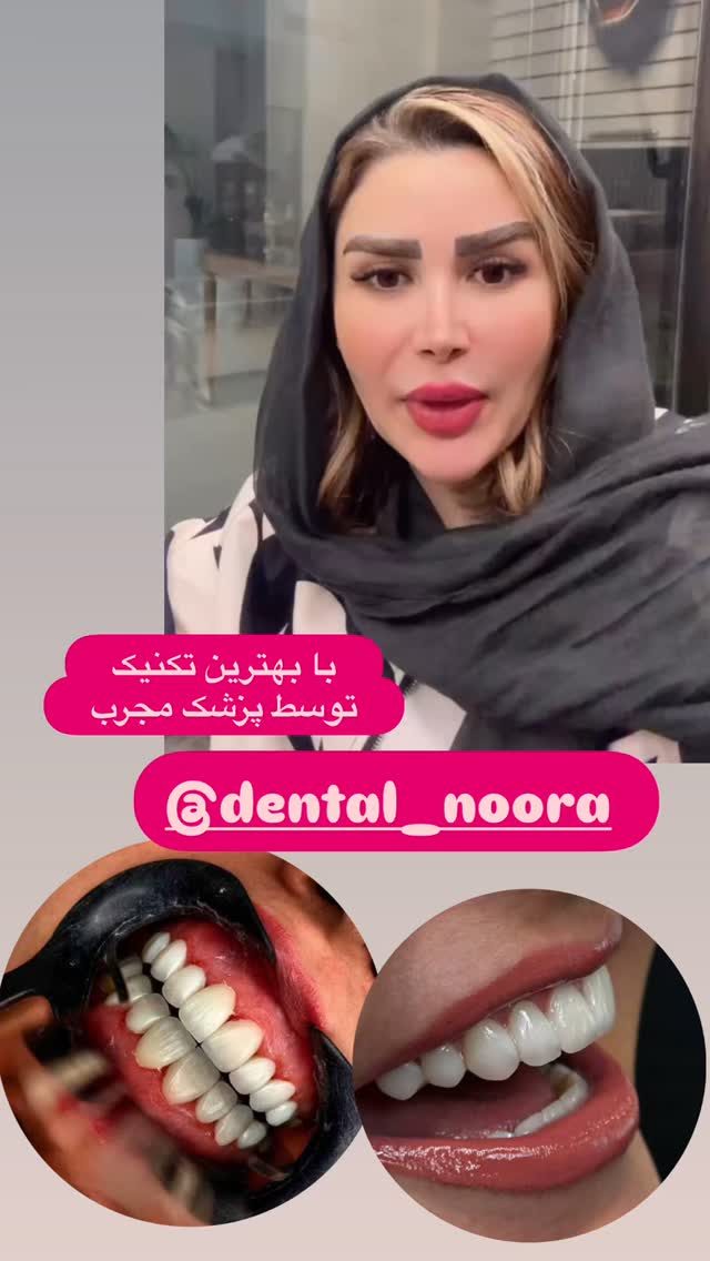  جدید ترین استوری اینستاگرام الهه صاحبقران