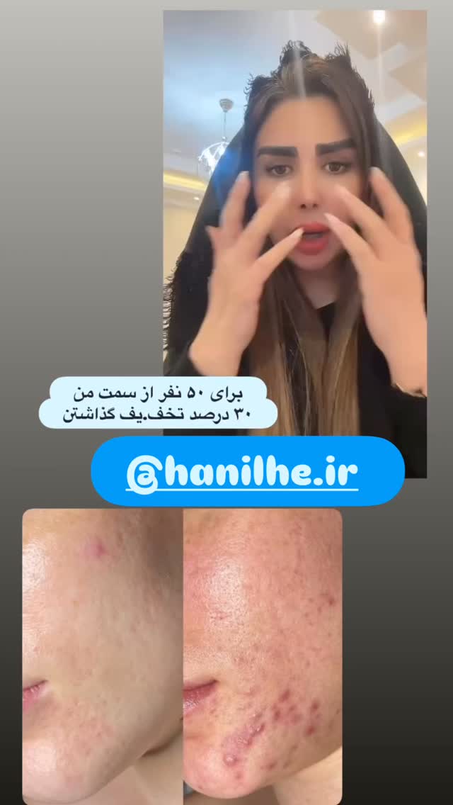  جدید ترین استوری اینستاگرام الهه صاحبقران