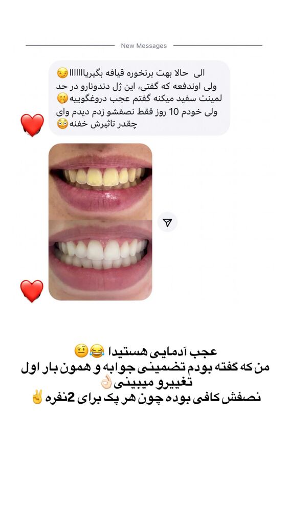  جدید ترین استوری اینستاگرام الهه صاحبقران