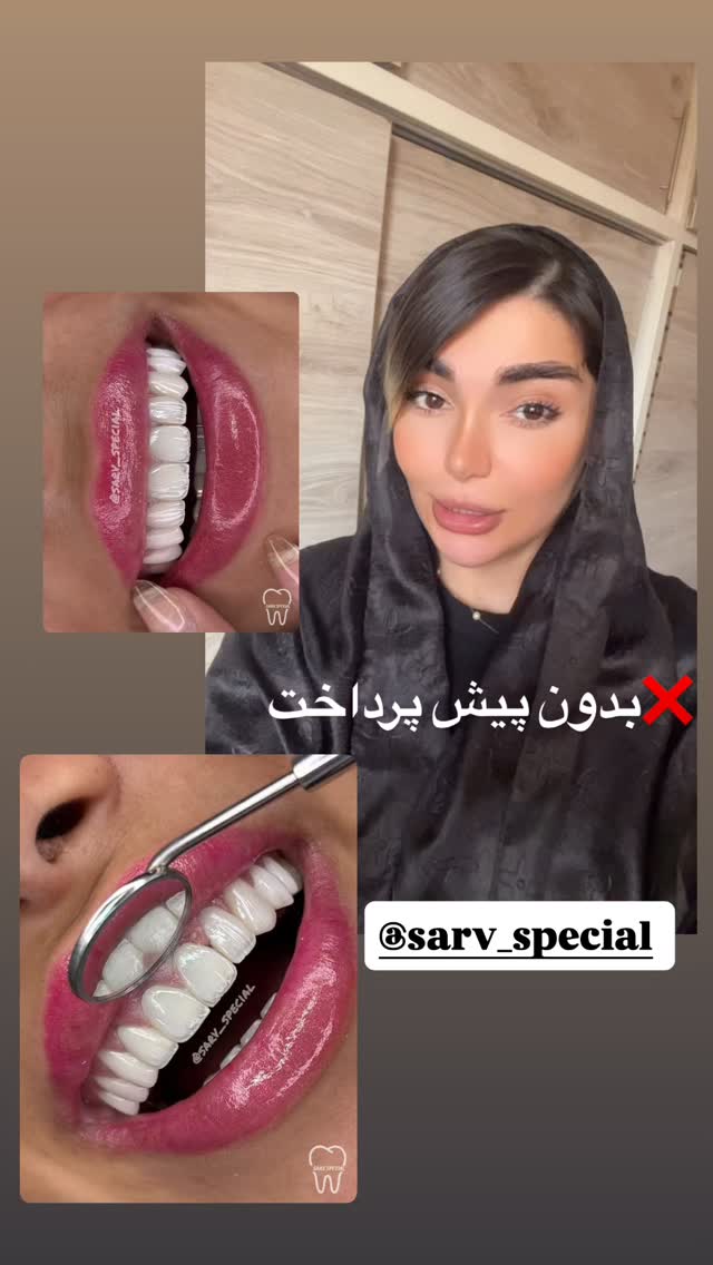  جدید ترین استوری اینستاگرام الیناز ادیب