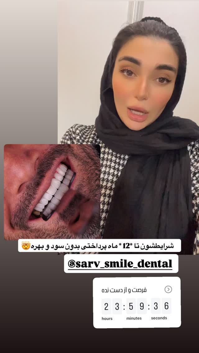  جدید ترین استوری اینستاگرام الیناز ادیب
