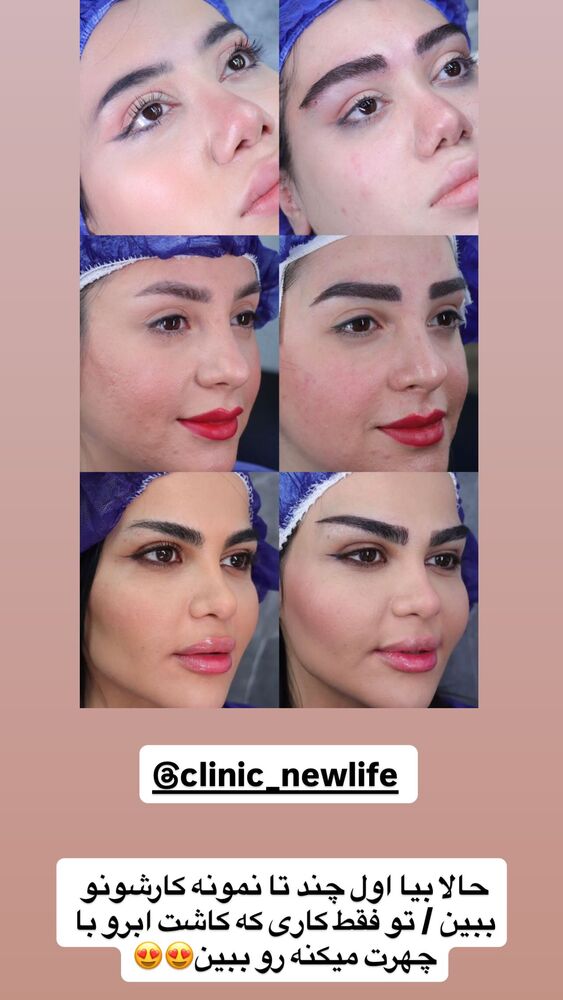  جدید ترین استوری اینستاگرام المیرا جلالی