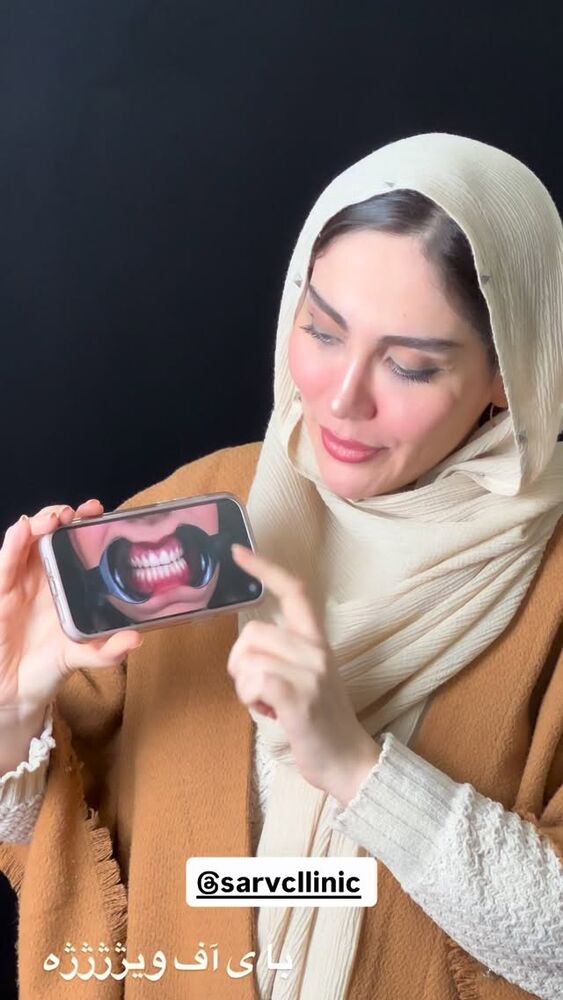  جدید ترین استوری اینستاگرام المیرا جلالی