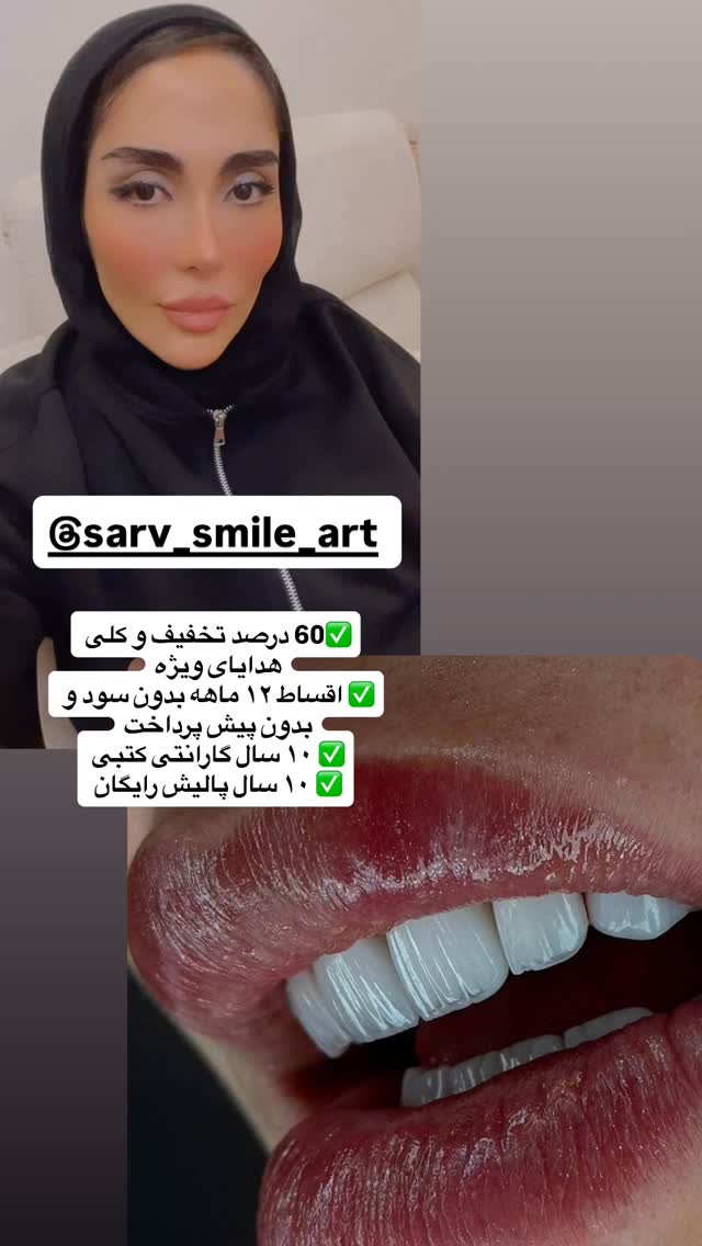  جدید ترین استوری اینستاگرام المیرا جلالی