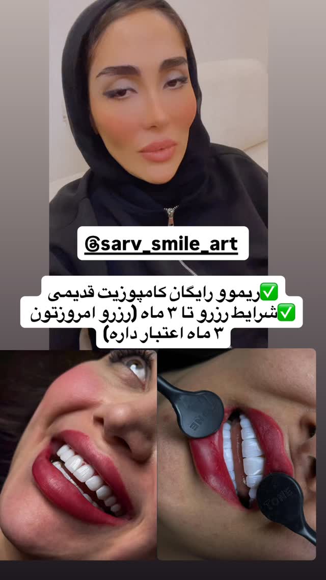  جدید ترین استوری اینستاگرام المیرا جلالی
