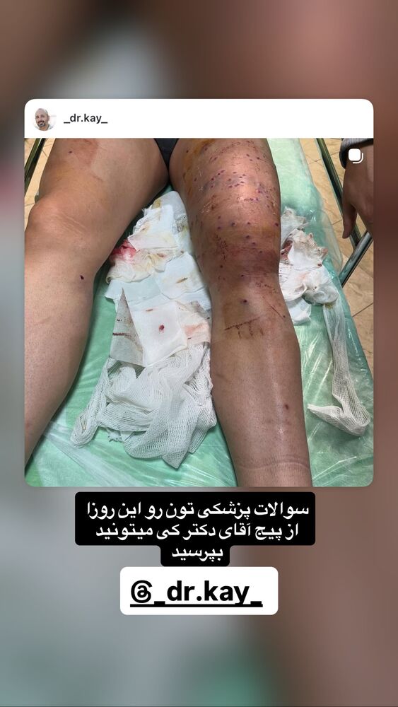  جدید ترین استوری اینستاگرام بردیا زارعی
