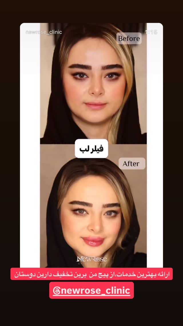 جدید ترین استوری اینستاگرام عرفان شمالی