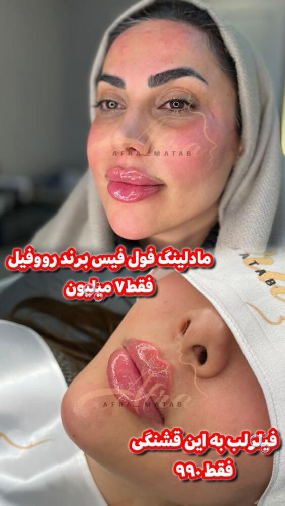  جدید ترین استوری اینستاگرام سیسی
