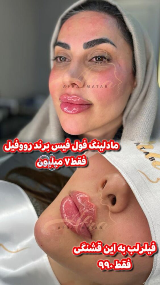  جدید ترین استوری اینستاگرام سیسی