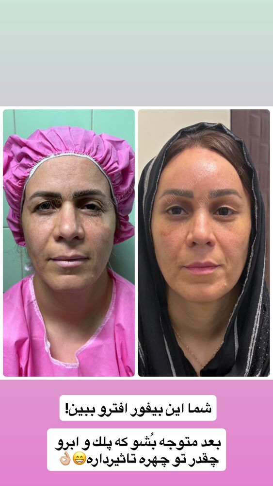  جدید ترین استوری اینستاگرام سیسی