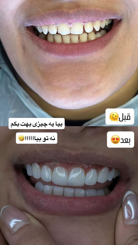  جدید ترین استوری اینستاگرام سیسی