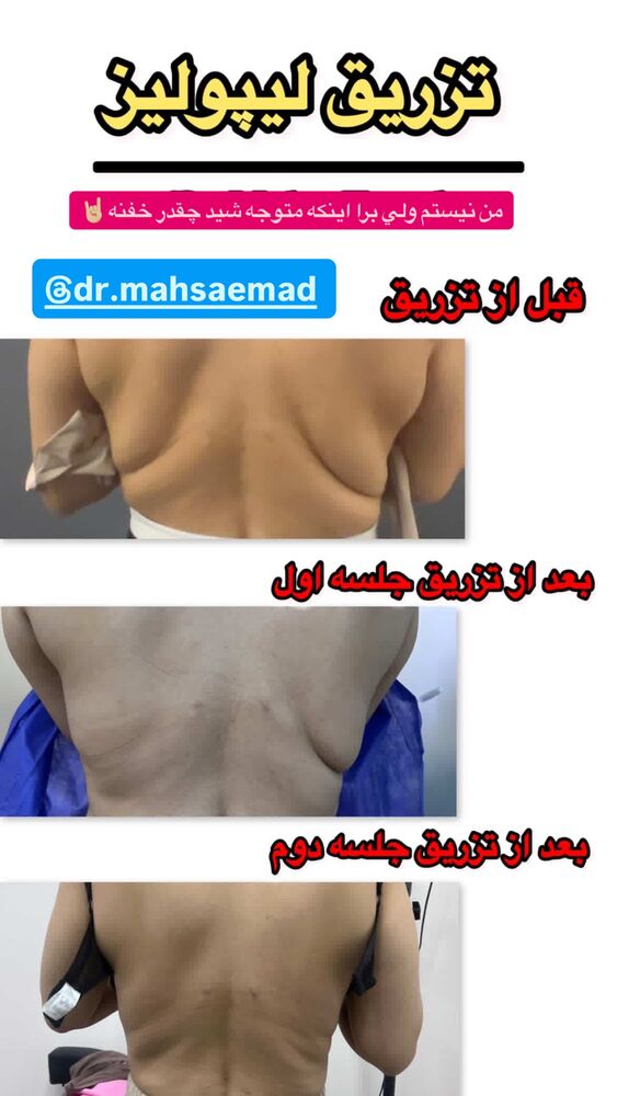  جدید ترین استوری اینستاگرام سیسی
