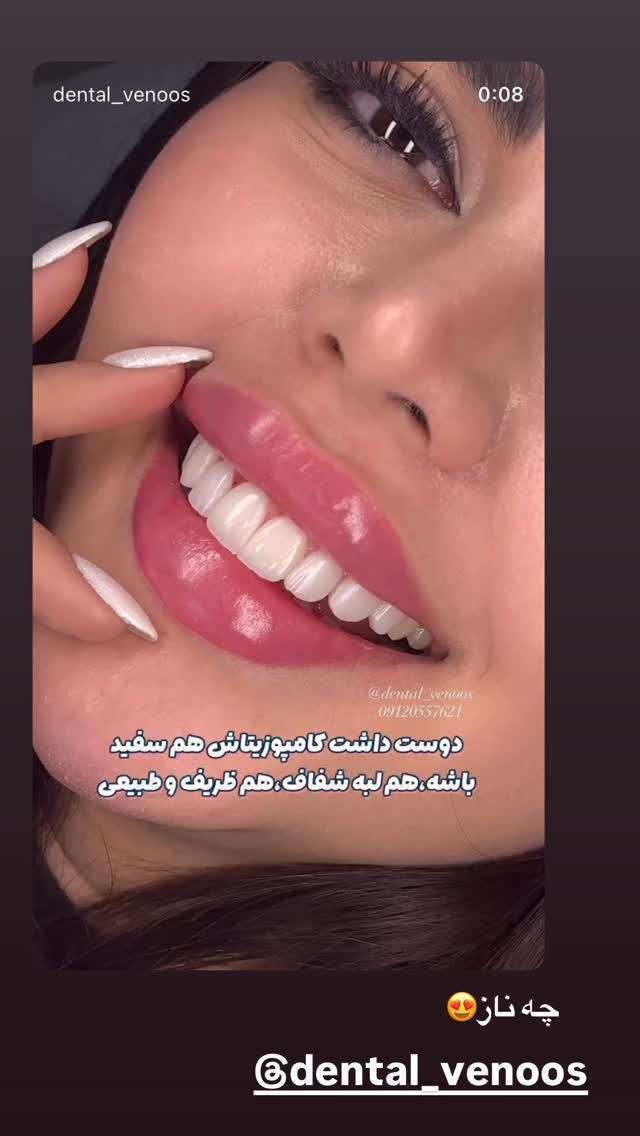  جدید ترین استوری اینستاگرام سیسی