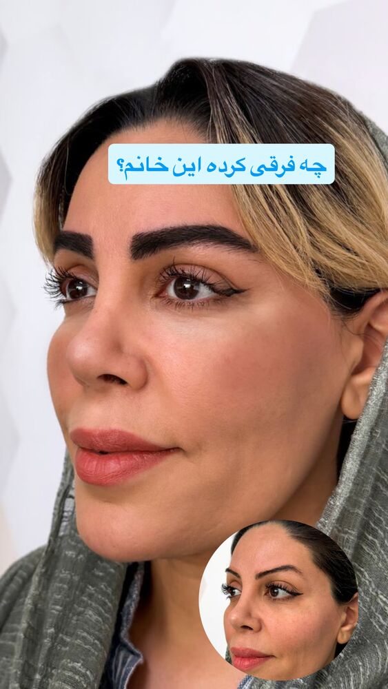  جدید ترین استوری اینستاگرام سیسی