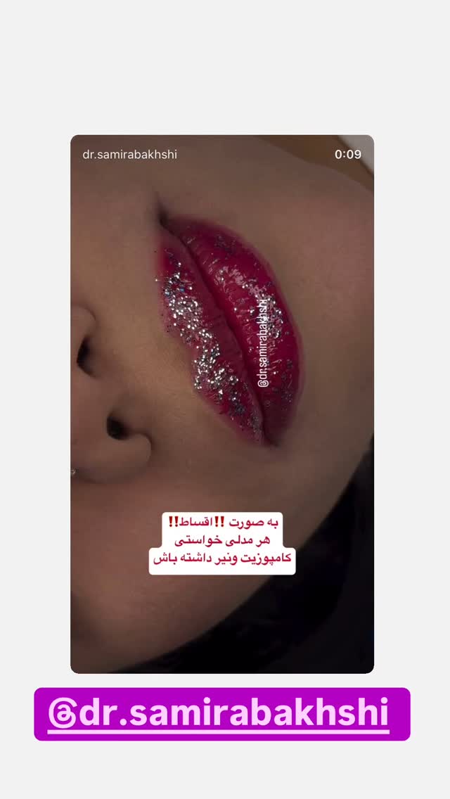  جدید ترین استوری اینستاگرام فرید کنزو