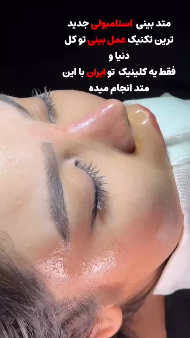  جدید ترین استوری اینستاگرام فرید کنزو