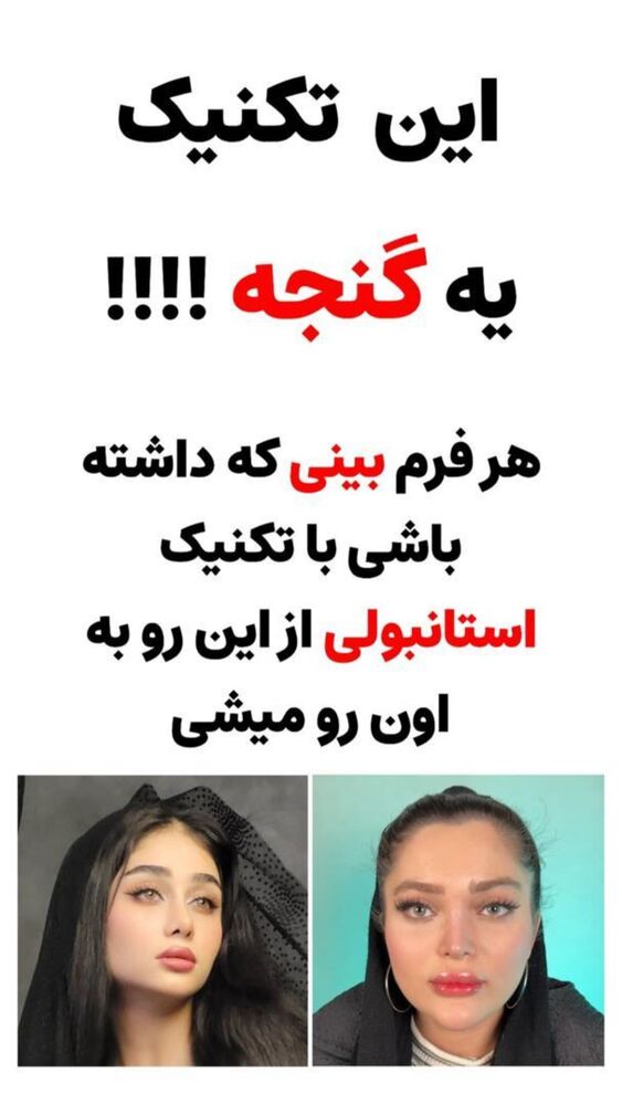  جدید ترین استوری اینستاگرام فرید کنزو