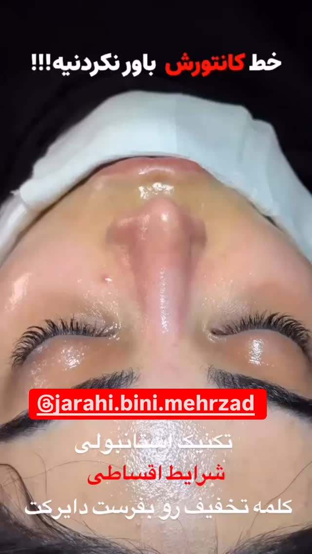  جدید ترین استوری اینستاگرام فرید کنزو