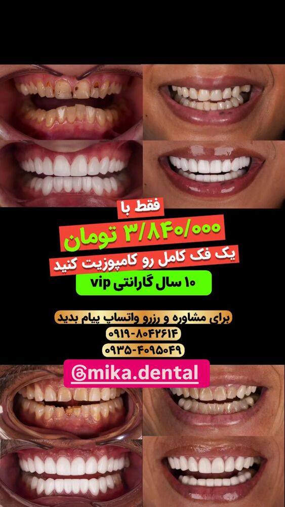  جدید ترین استوری اینستاگرام فرید کنزو