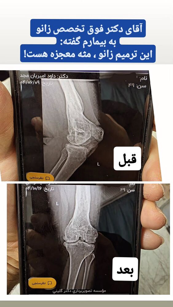  جدید ترین استوری اینستاگرام فرجود شکوهی
