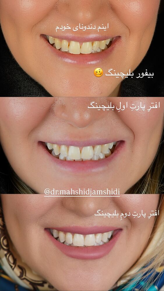  جدید ترین استوری اینستاگرام فرناز بهنود