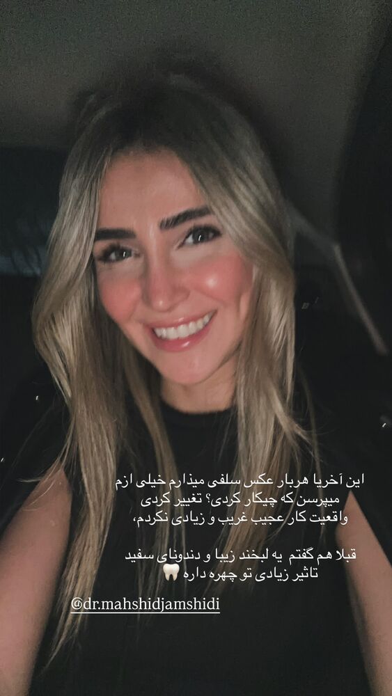  جدید ترین استوری اینستاگرام فرناز بهنود