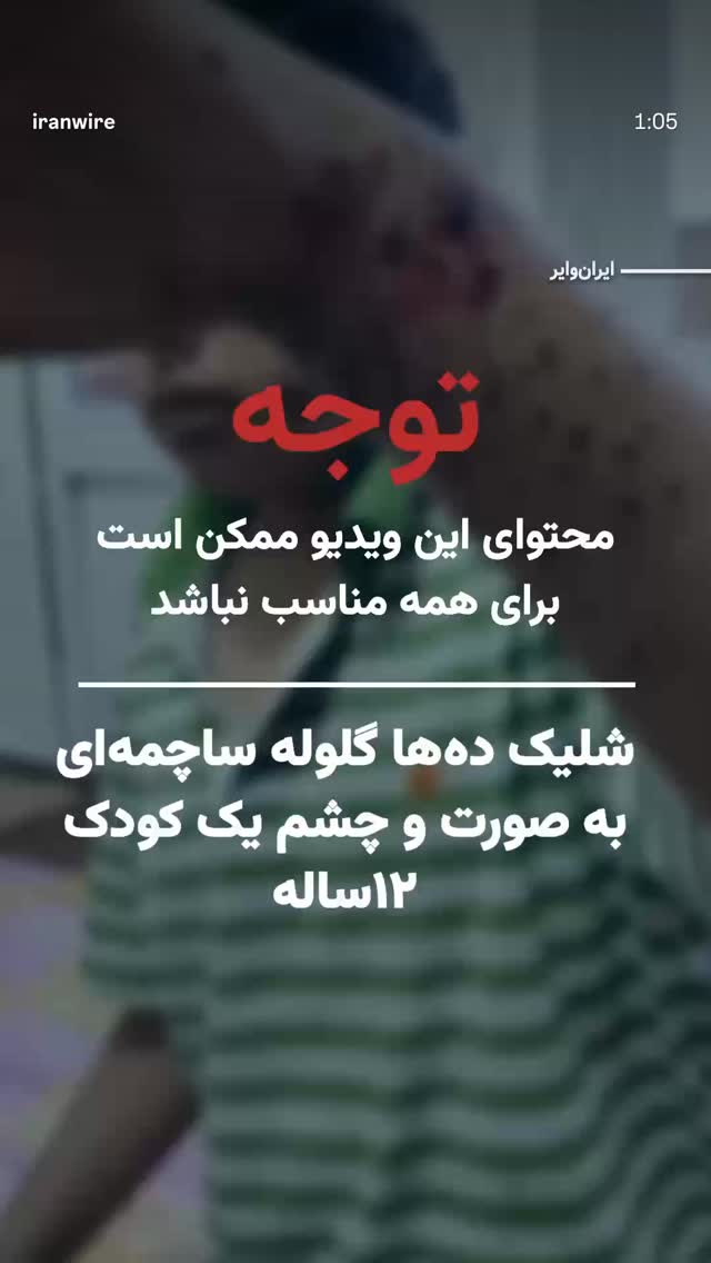  جدید ترین استوری اینستاگرام فرشاد
