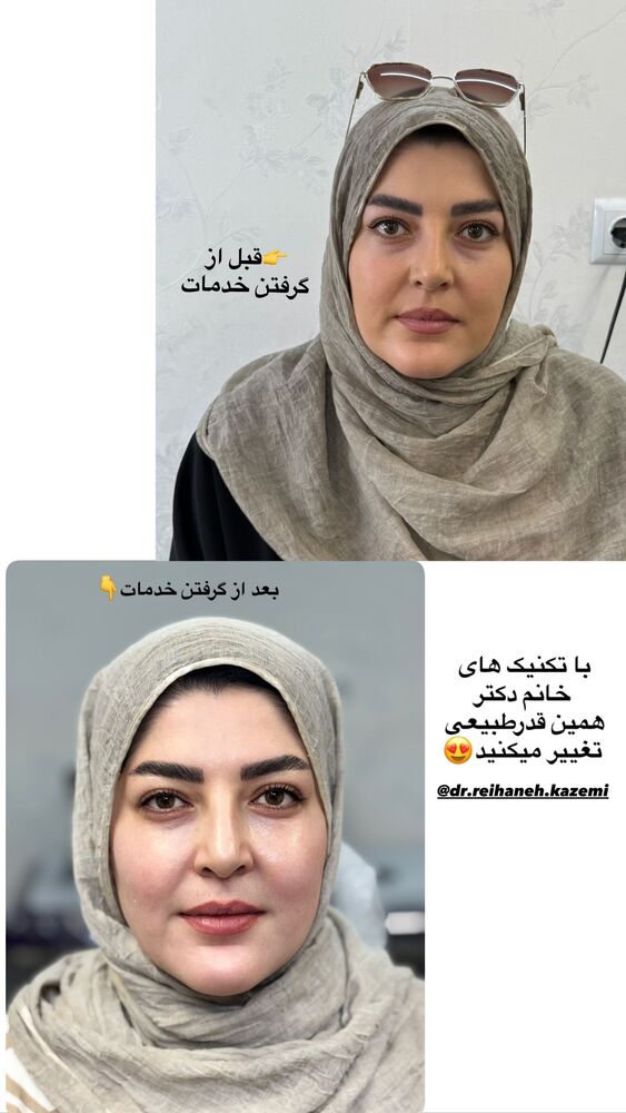  جدید ترین استوری اینستاگرام فرزانه رستم خان