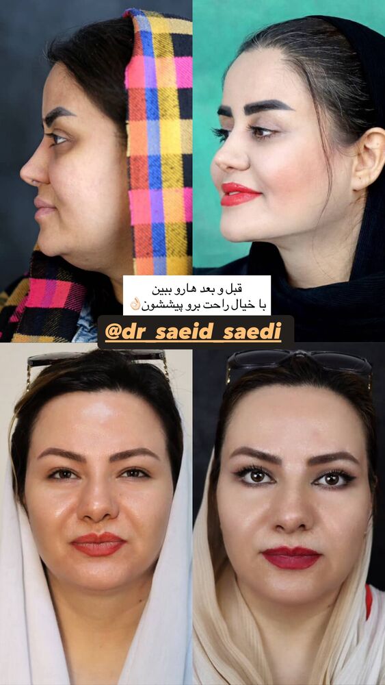  جدید ترین استوری اینستاگرام فاطیما (فاطیما استایل)