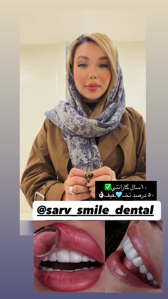  جدید ترین استوری اینستاگرام فاطیما (فاطیما استایل)