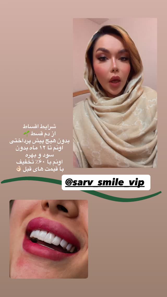  جدید ترین استوری اینستاگرام فاطیما (فاطیما استایل)