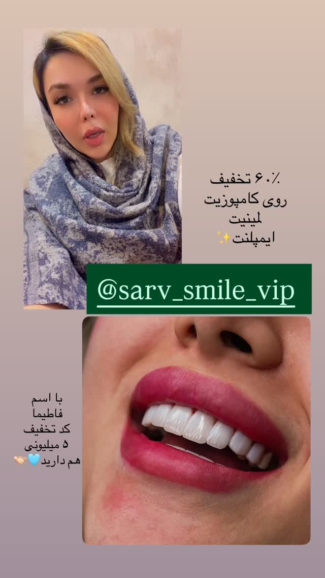  جدید ترین استوری اینستاگرام فاطیما (فاطیما استایل)