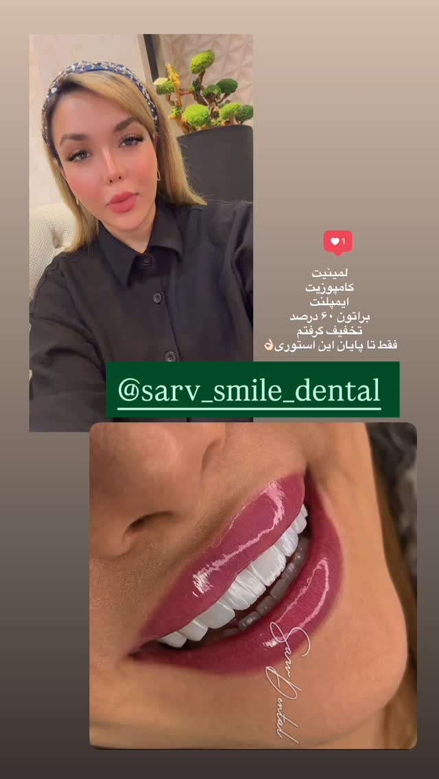  جدید ترین استوری اینستاگرام فاطیما (فاطیما استایل)
