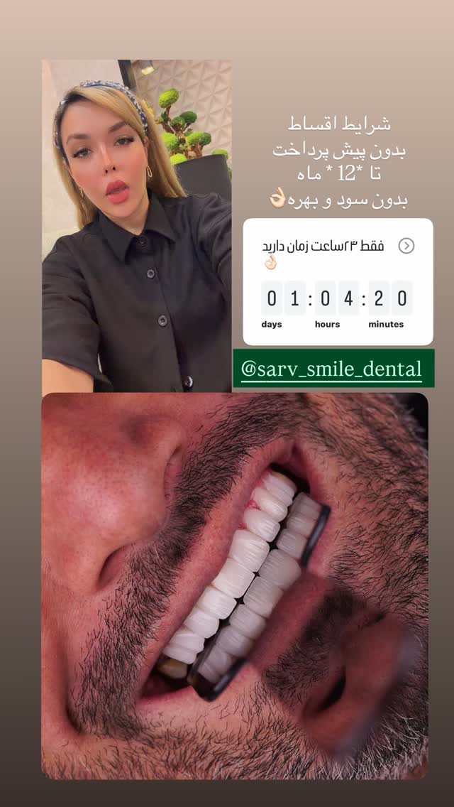  جدید ترین استوری اینستاگرام فاطیما (فاطیما استایل)