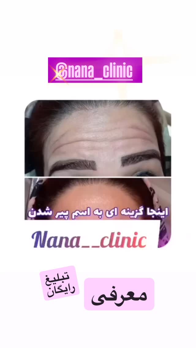  جدید ترین استوری اینستاگرام فلور نظری
