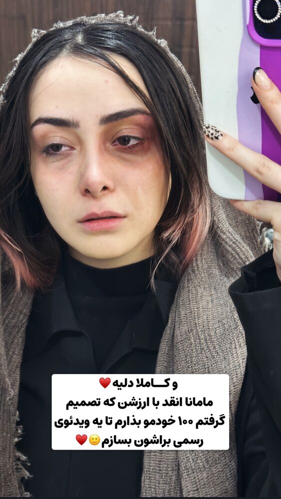  جدید ترین استوری اینستاگرام هلیا فارسی