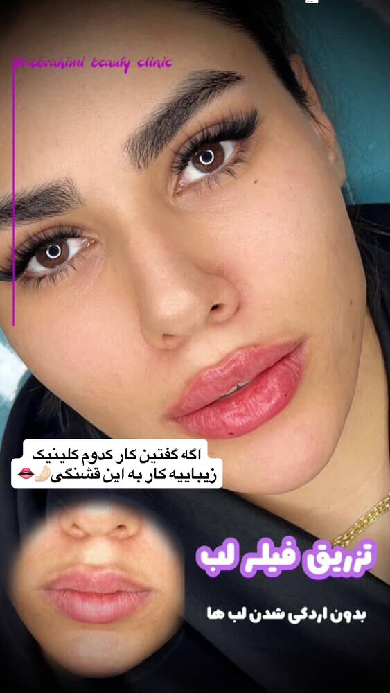  جدید ترین استوری اینستاگرام فاطمه مکاری
