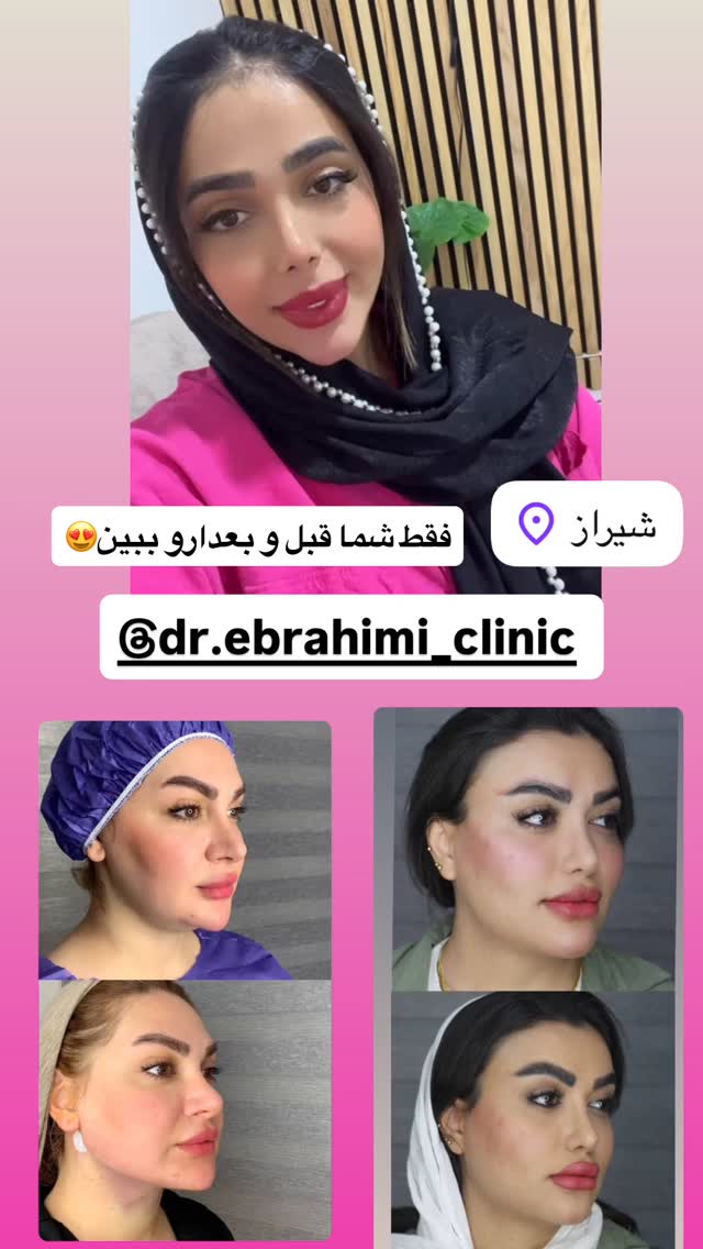  جدید ترین استوری اینستاگرام فاطمه مکاری